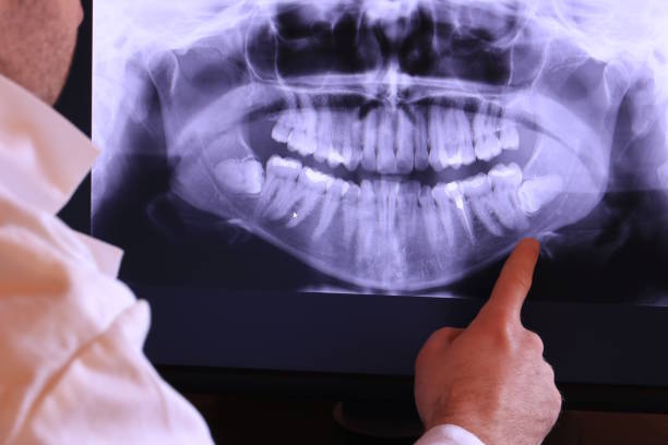 Best Weekend Emergency Dentist in Auberry, CA