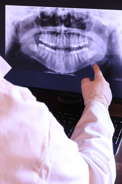 Best Broken or Cracked Tooth Emergency Dentist in Auberry, CA